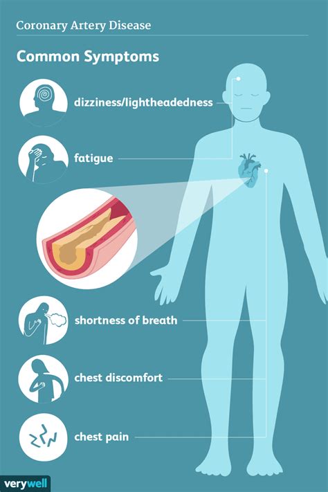 koronare herzkrankheit symptome